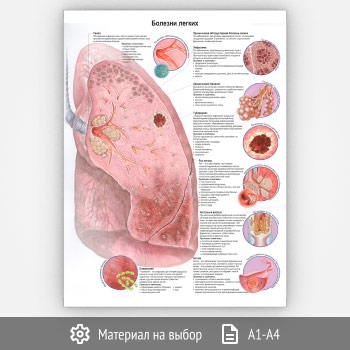 ������ �������� ������� (���-09, 1 ����)