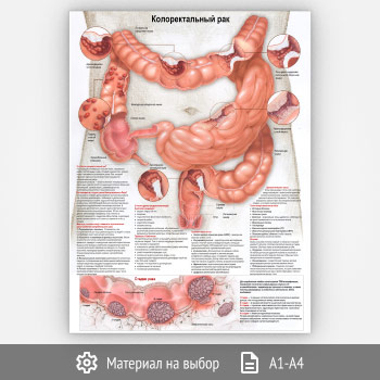 ������ ��������������� ��� (���-14, 1 ����)